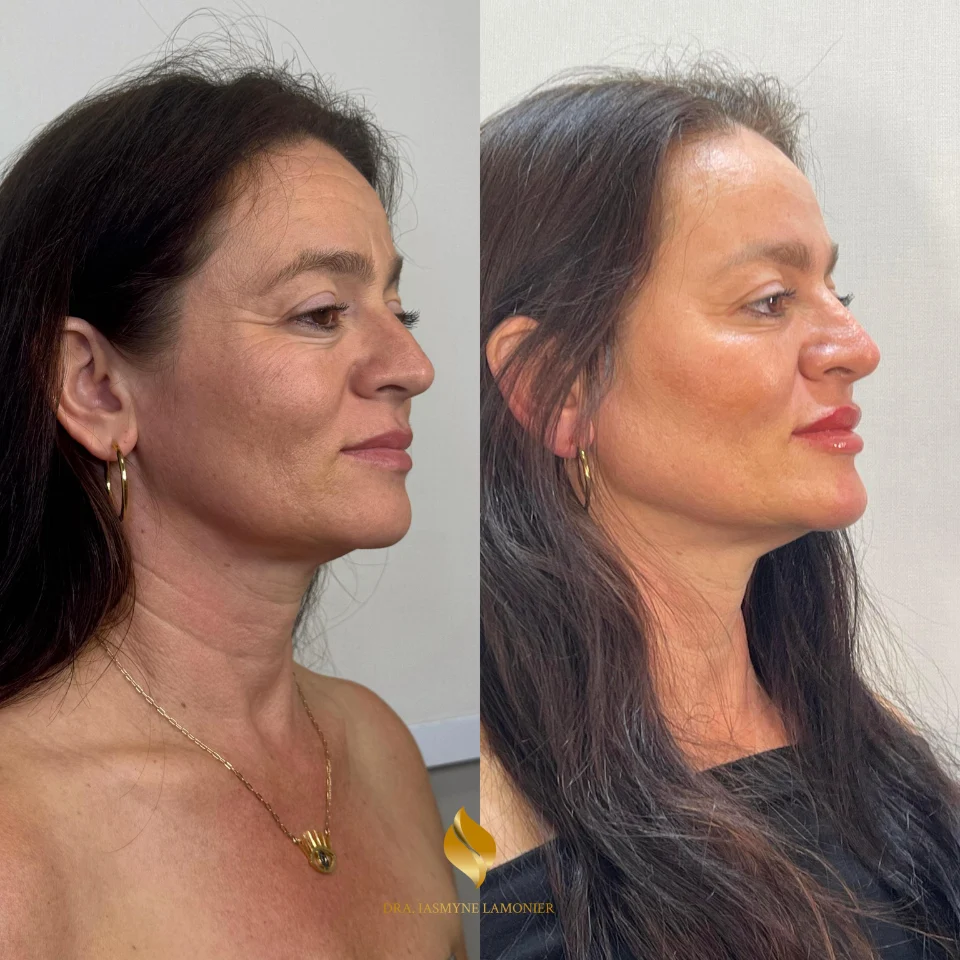 Iasmyne antes e depois (1)