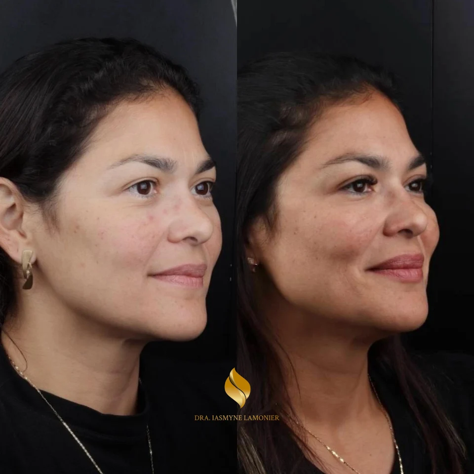 Iasmyne antes e depois (2)