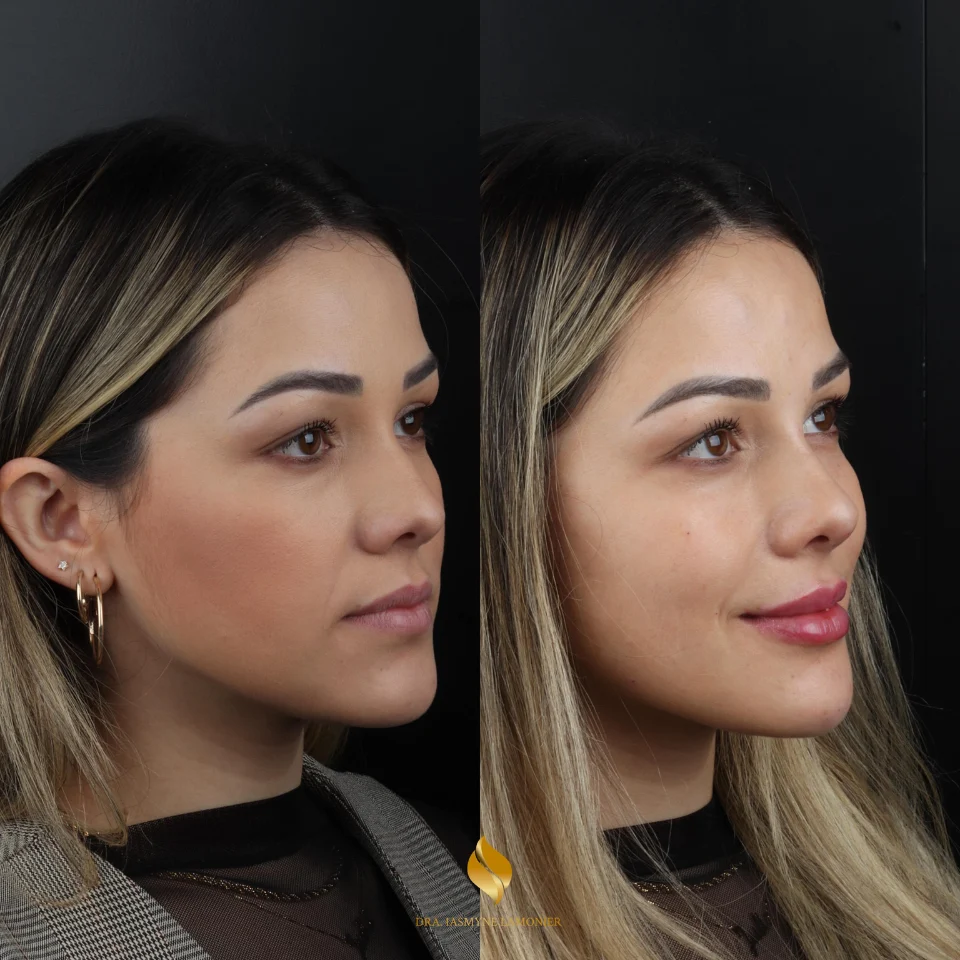 Iasmyne antes e depois (3)