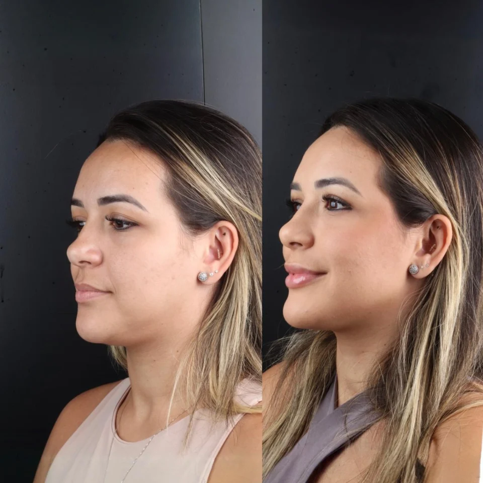 Iasmyne antes e depois (5)