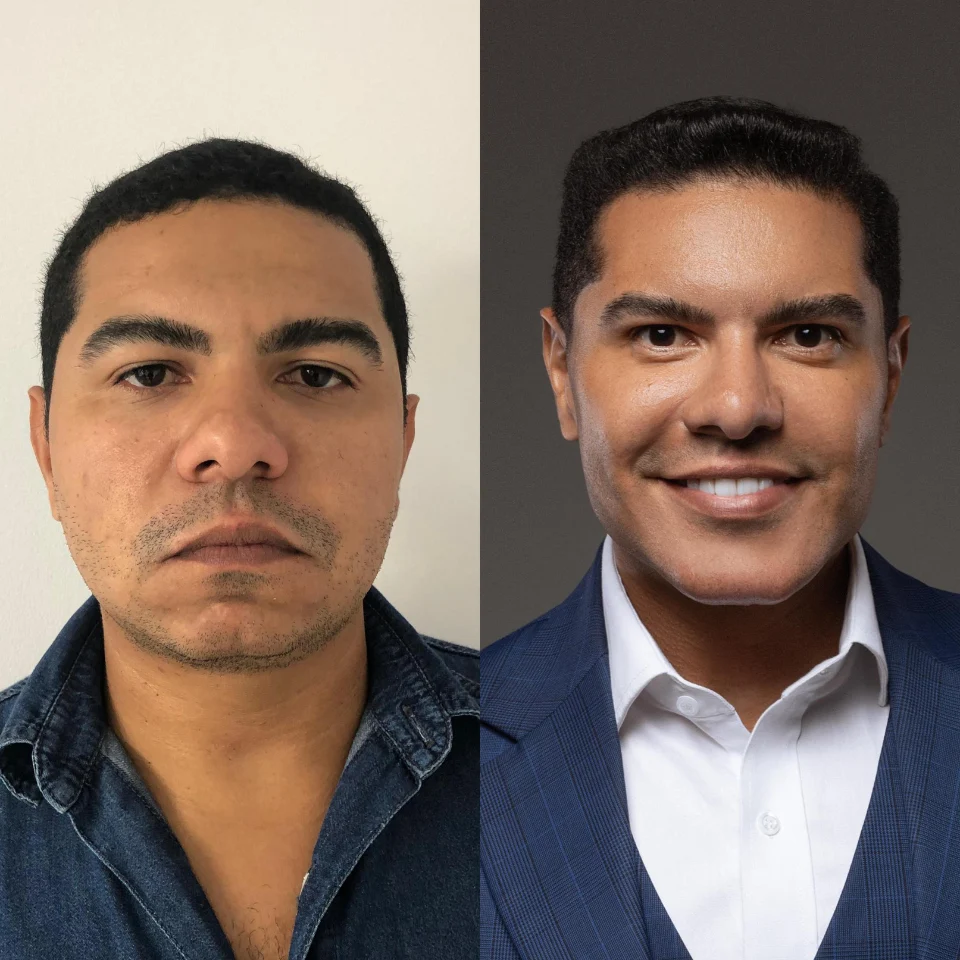 Iasmyne antes e depois (6)