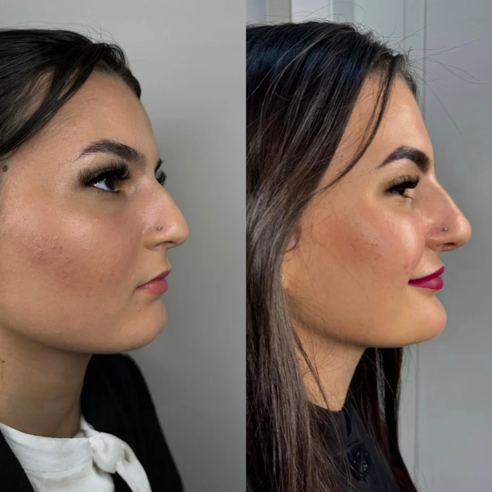 Iasmyne antes e depois (7)