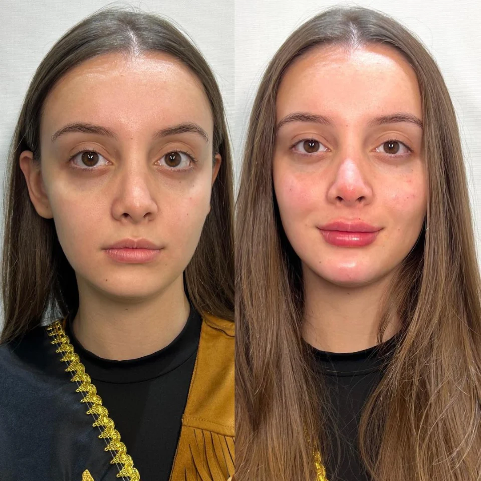Iasmyne antes e depois (9)